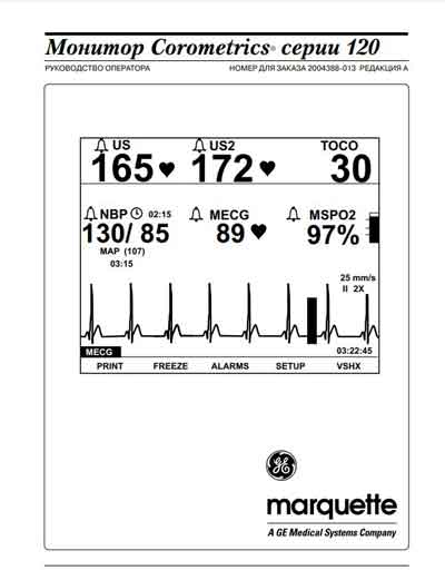 Руководство оператора Operators Guide на Corometrics серии 120 Rev.A (Marquette) [General Electric]