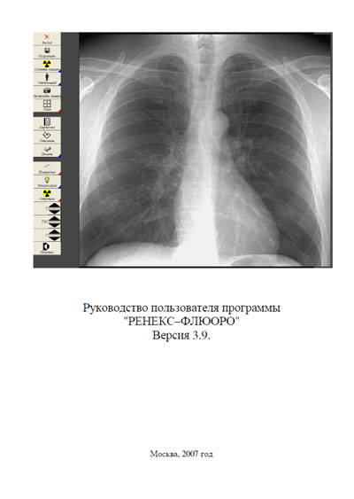 Руководство пользователя, Users guide на Рентген Флюорограф Ренекс Флюоро ПО Версия 3.9